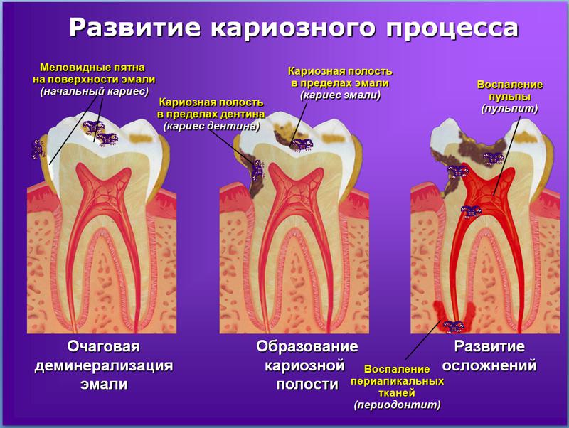Почему сильно зуб